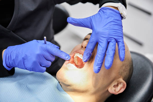 Best Emergency Dental Care for Broken or Chipped Teeth in Crosby, ND