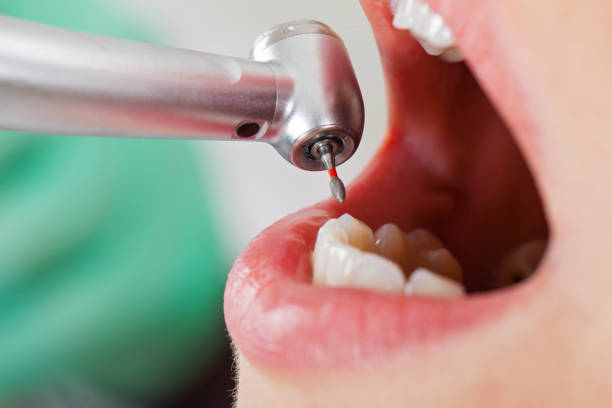 Best Urgent Care for Lost Fillings or Crowns in Crosby, ND